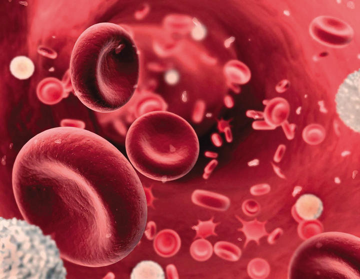 Hemofilia, enfermedad genética que impide la buena coagulación de la sangre. (Foto: Archivo Siglo Nuevo)