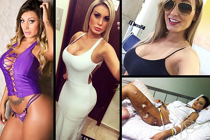 Andressa estuvo bajo cuidados médicos durante más de un mes. (INSTAGRAM)