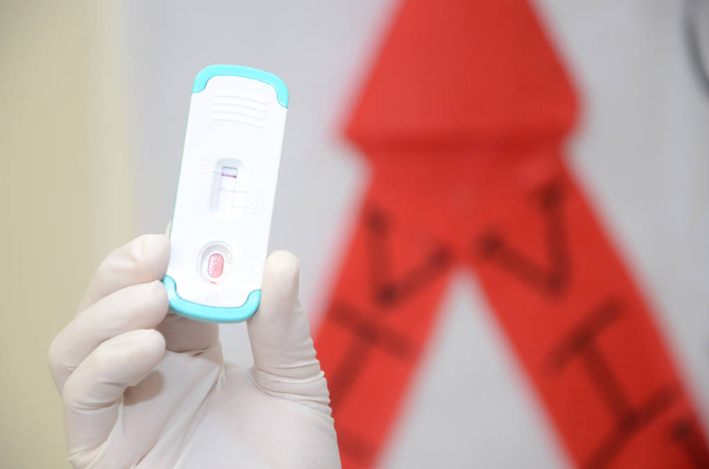 Atención. En el Capasits Torreón se realizan pruebas rápidas para la detección del VIH, sin costo. (ARCHIVO)