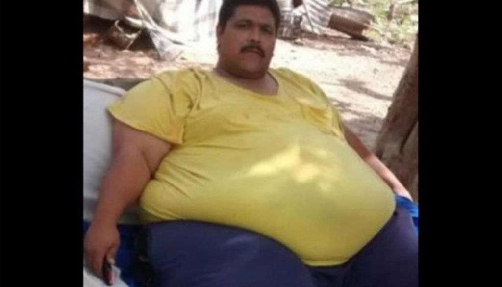 Moreno Sepúlveda, que llegó a pesar más de 450 kilogramos y el 28 de octubre pasado se sometió a una cirugía bariátrica, fue operado el 19 de noviembre pasado en el Hospital General de Ciudad Obregón.
