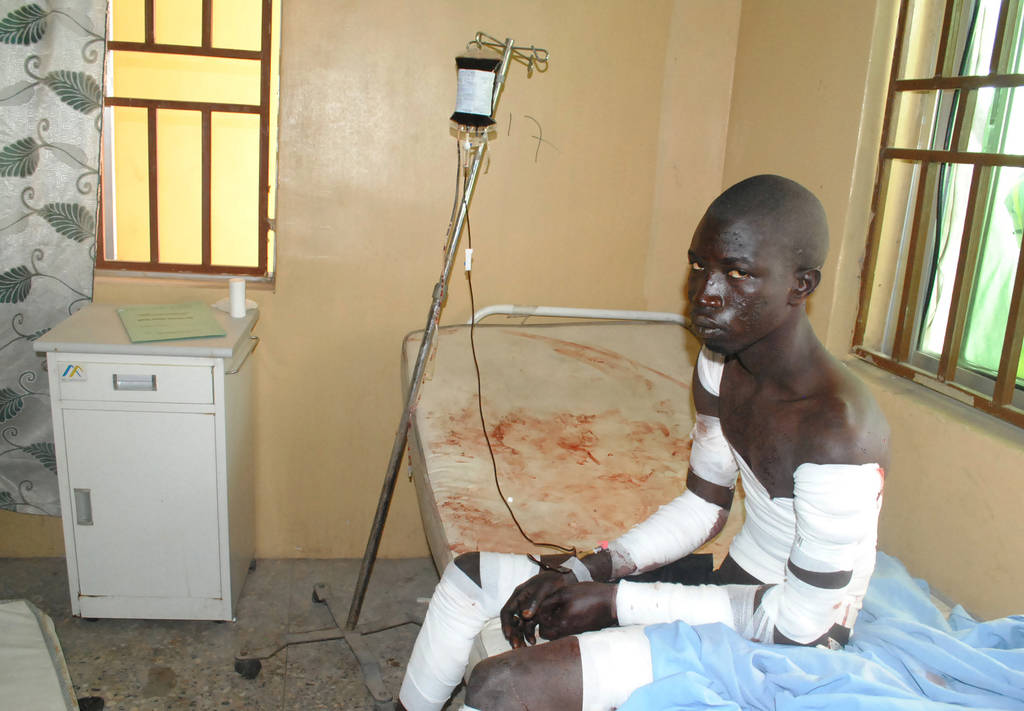 Atención. Un hombre es atendido en un nosocomio en Nigeria tras el atentado. 