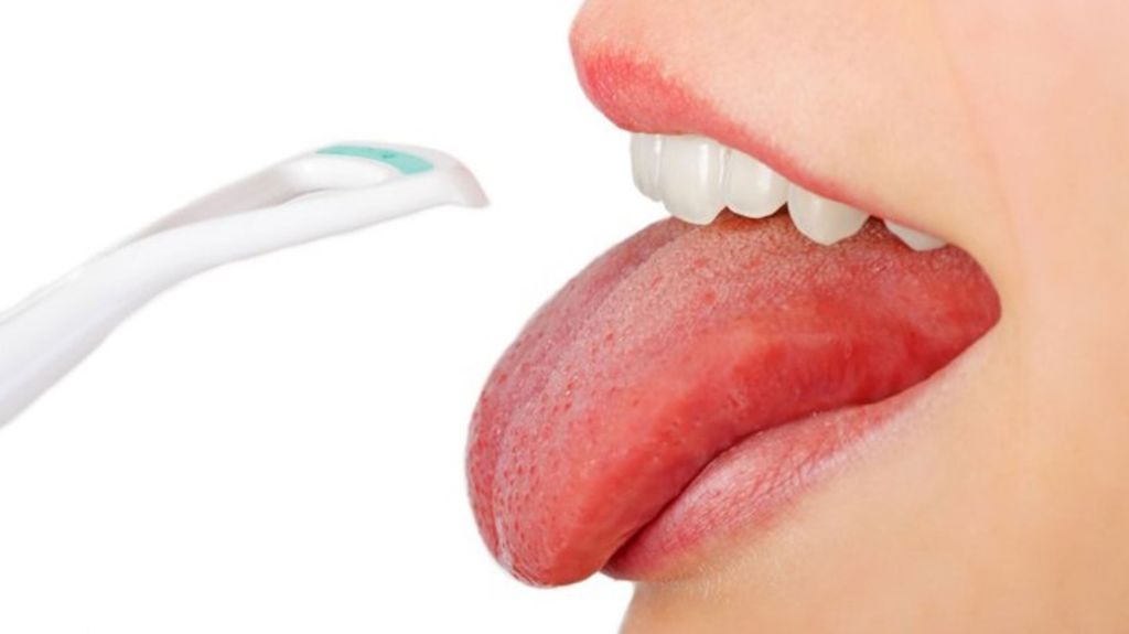 La prótesis de lengua está hecha de resina, de manera que el paciente pueda moverla de arriba a abajo, y se conecta a los dientes anteriores gracias a un alambre. (INTERNET)