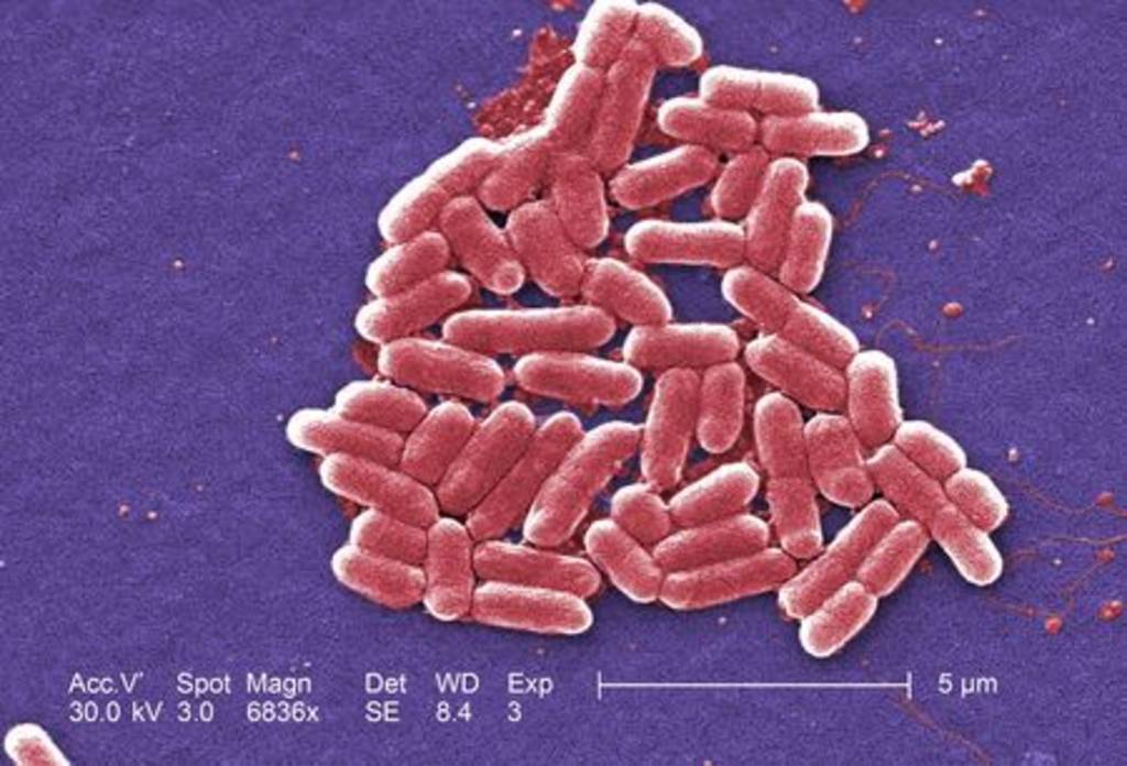 Nuevo enemigo. Estados Unidos ha detectado el primer caso de 'superbacteria' resistente a los antibióticos.