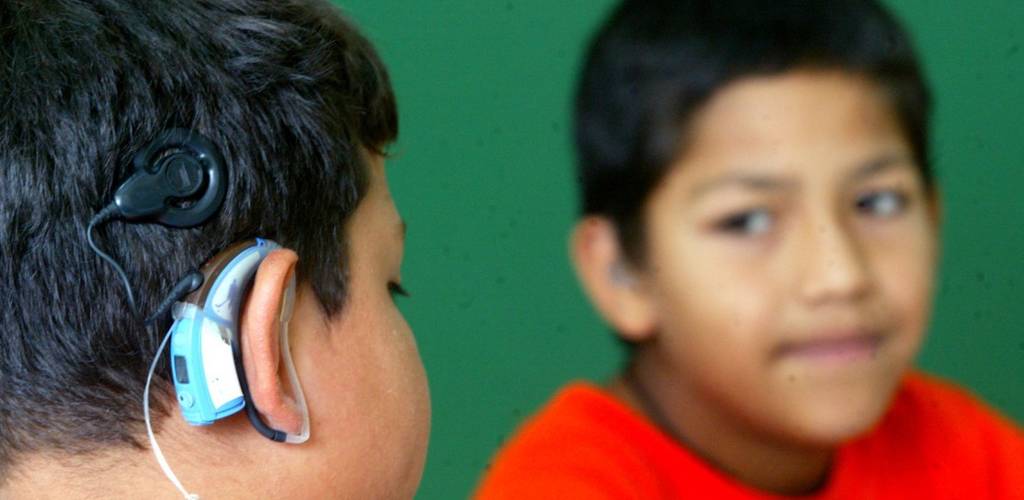 Avance. Dentro de los beneficios que los implantes cocleares es que los niños ya no van a estar en la oscuridad de la sordera.