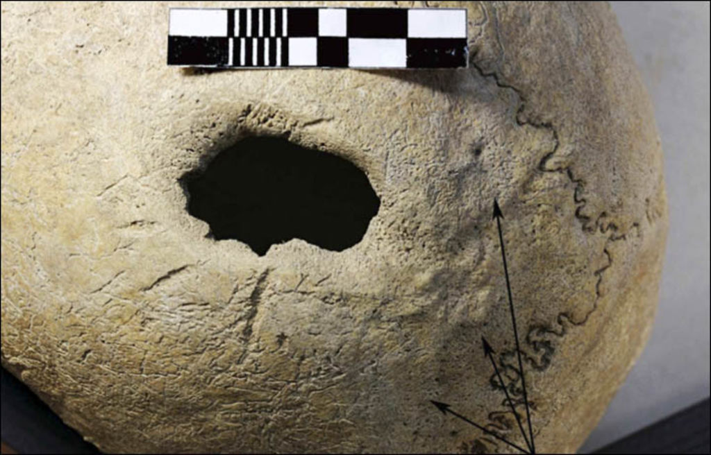 los arqueólogos han determinado la forma como se practicaba la cirugía cerebral en la Edad del Bronce.