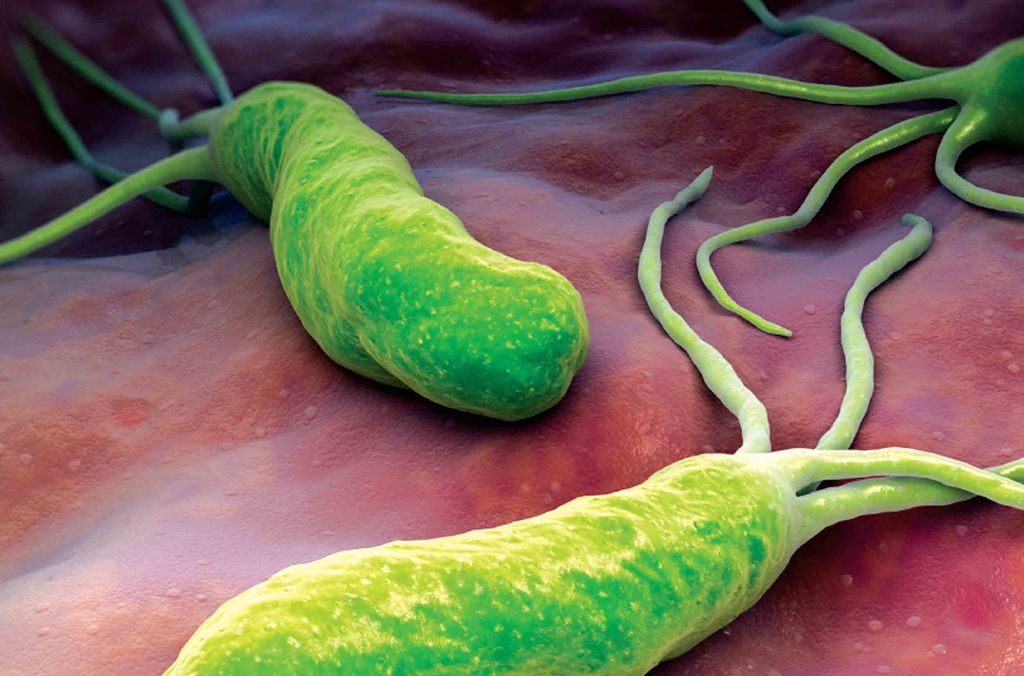 Helicobacter pylori es un tipo de bacteria que se encuentra en el estómago y permanece en la mucosa gástrica por años y se le considera la enfermedad bacteriana crónica más común en el mundo. (ARCHIVO)