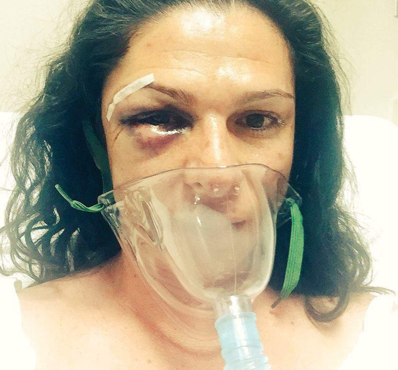 Ana Guevara fue agredida por cuatro hombres cuando viajaba de Valle de Bravo a la Ciudad de México. (TWITTER)