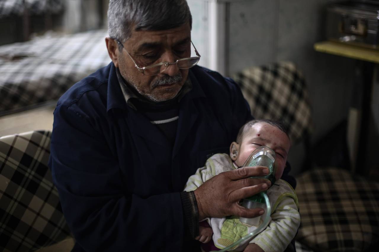 La cara de la guerra. Hala (de cinco meses de edad) un pequeño lesionado por una bomba en Duma. Siria, es ayudado por una persona para respirar. 