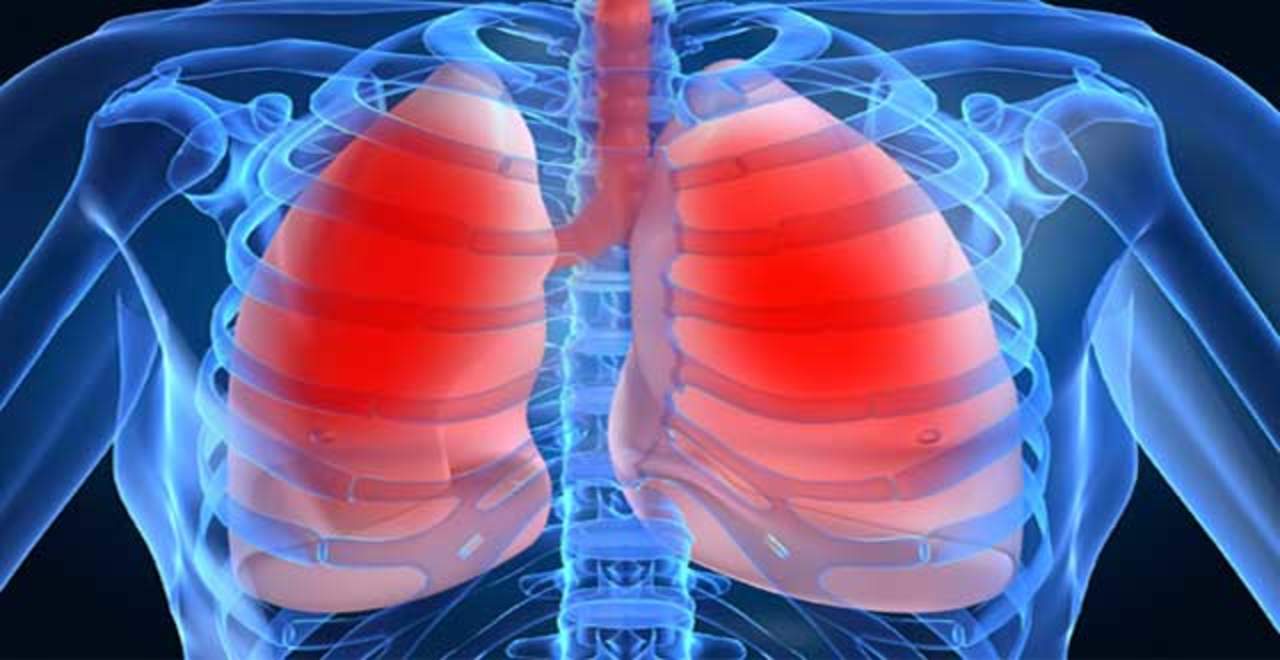 Hipertensión pulmonar en México afecta más a mujeres