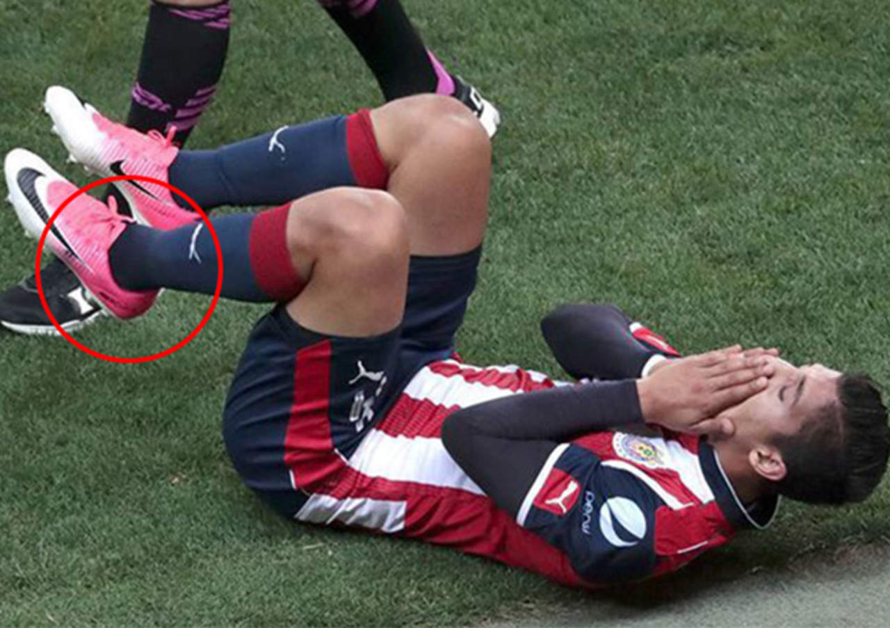 Impactante lesión deja fuera a jugador de Chivas