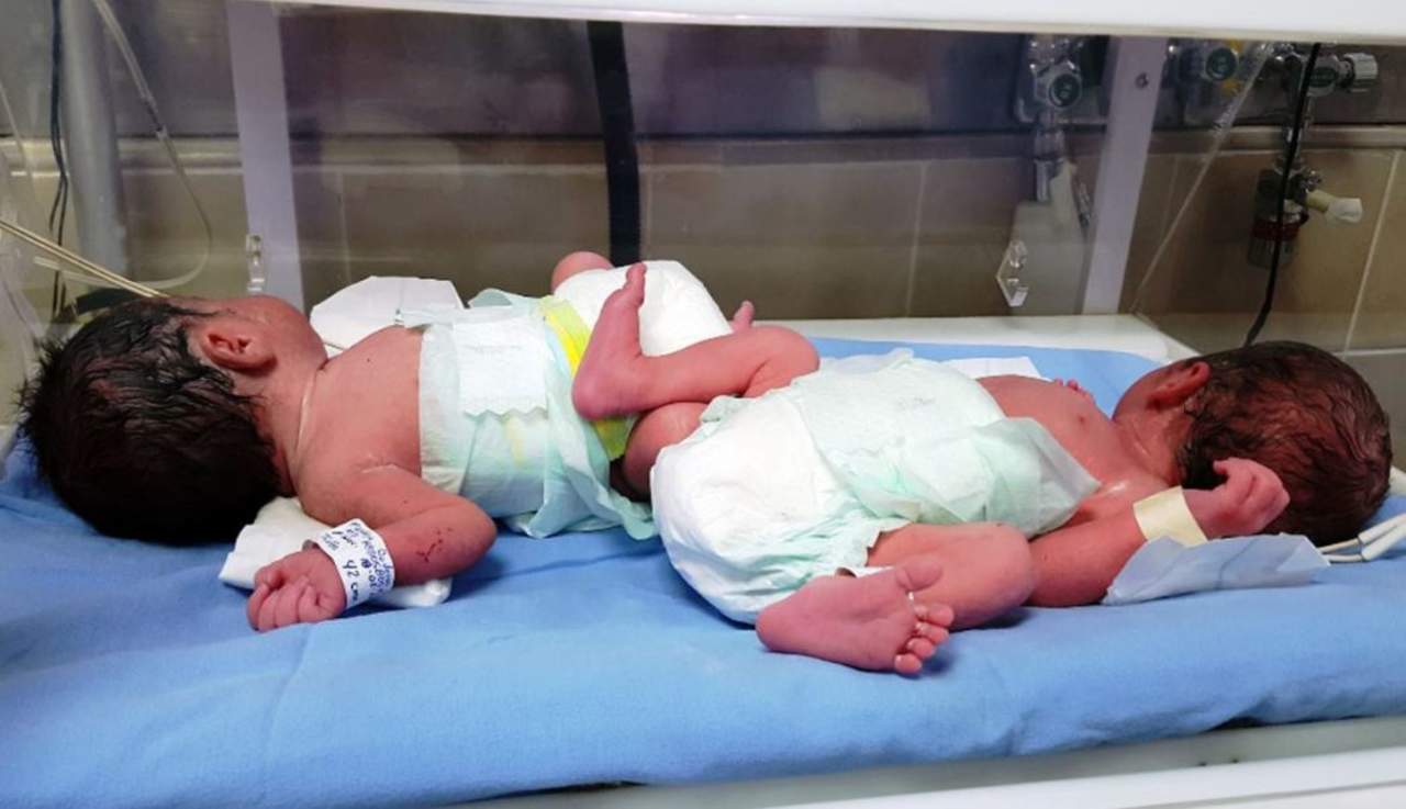 Los gemelos recibieron atención especializada en la unidad de cuidados intensivos neonatales y en el área de cuneros del Hospital General Regional Número 1 durante más de tres semanas. (ESPECIAL) 
