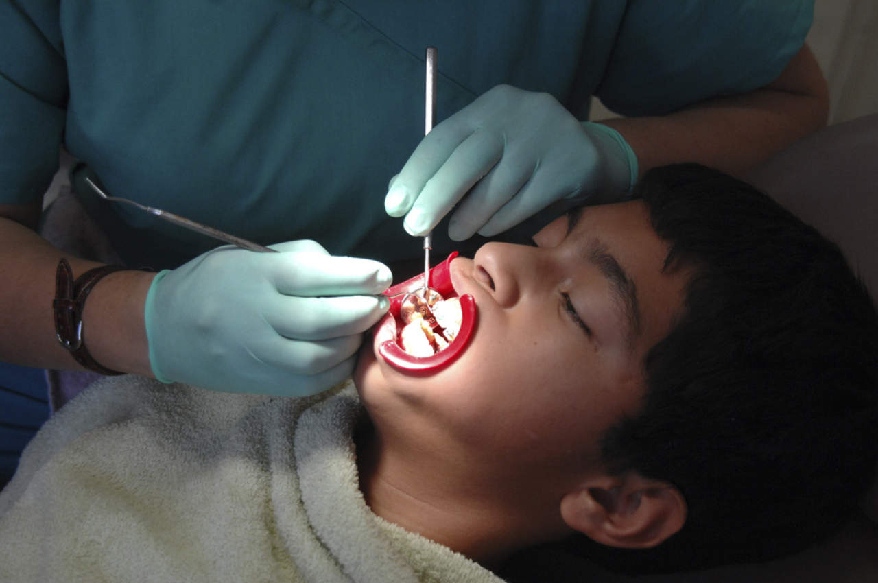 Entre un 70 y 90 % de los escolares en todo el mundo tienen caries dentales. (ARCHIVO)