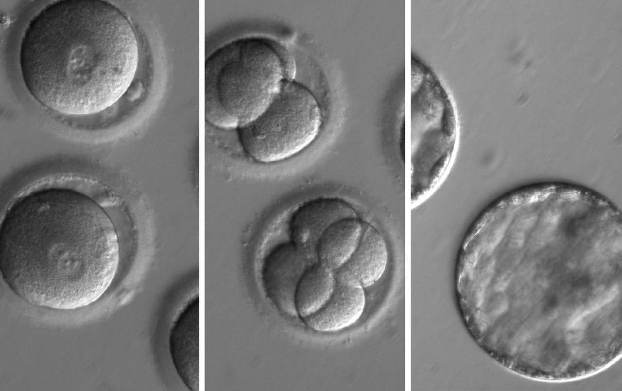Logro. Así es el desarrollo de embriones después de la coinyección de una enzima correctora de genes. (EFE)