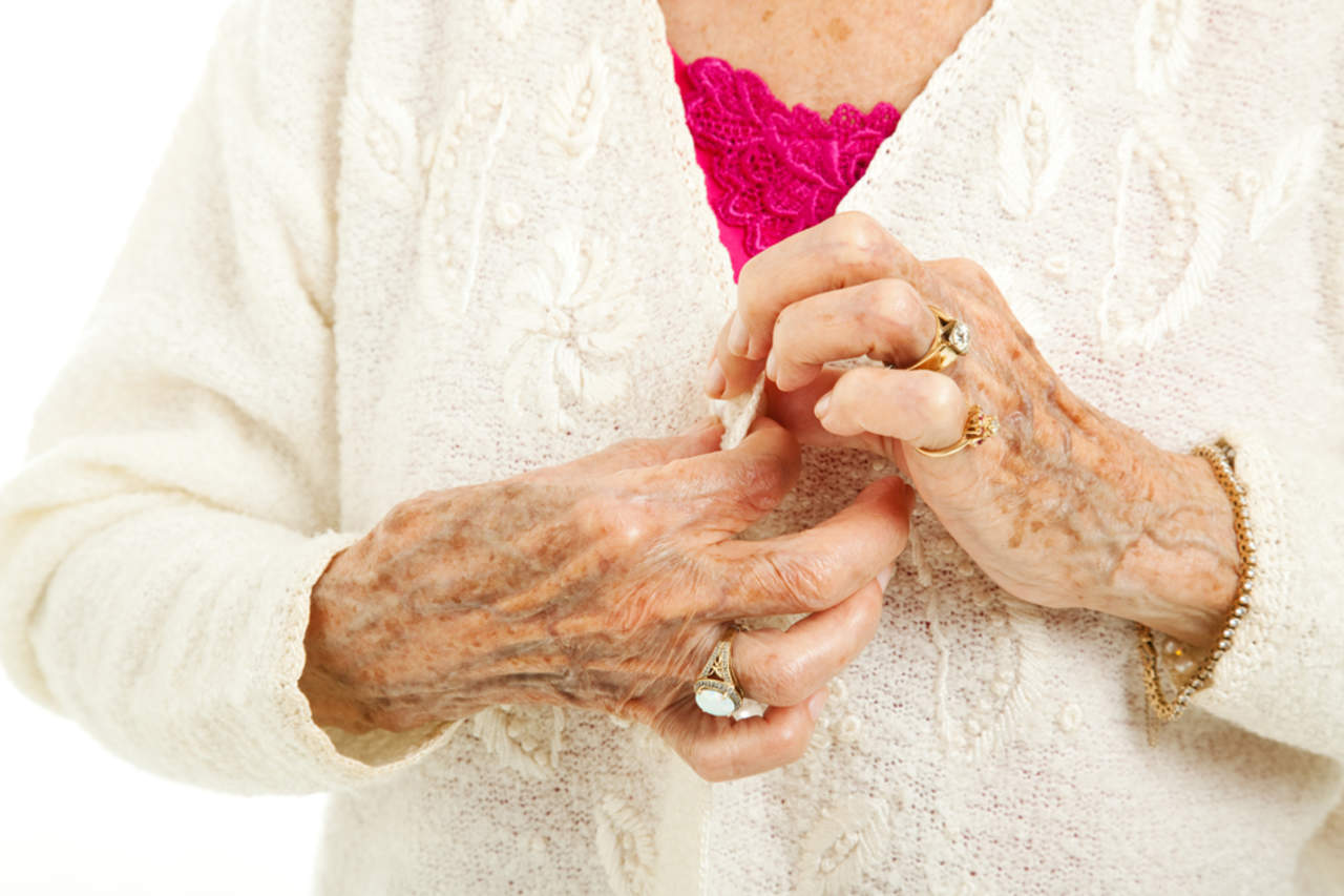 Artritis reumatoide, lo que debes saber