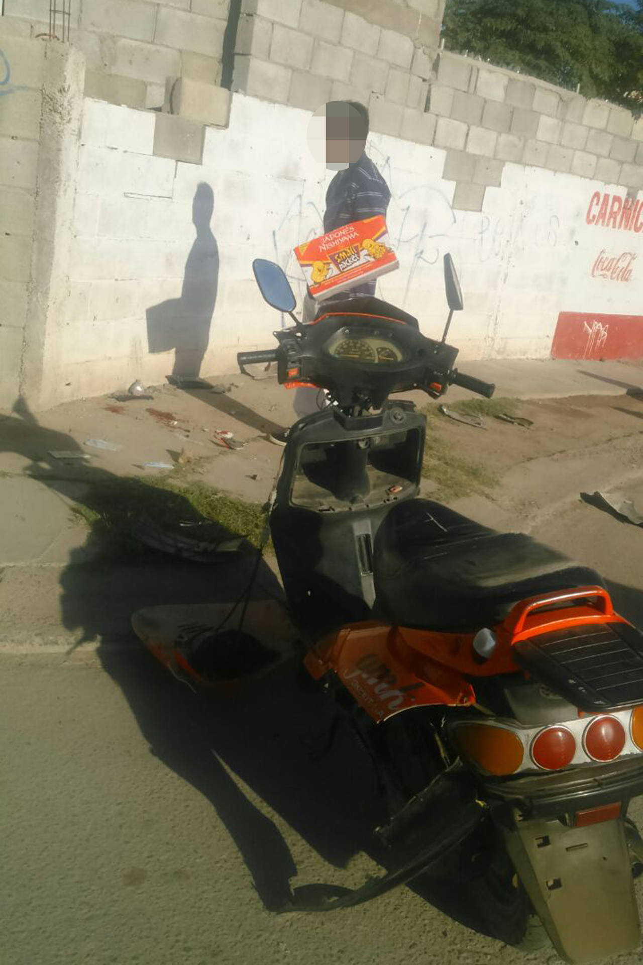 Choque. Joven motociclista termina con la mandíbula desprendida tras impactarse con una barda, en Gómez Palacio. (EL SIGLO DE TORREÓN)