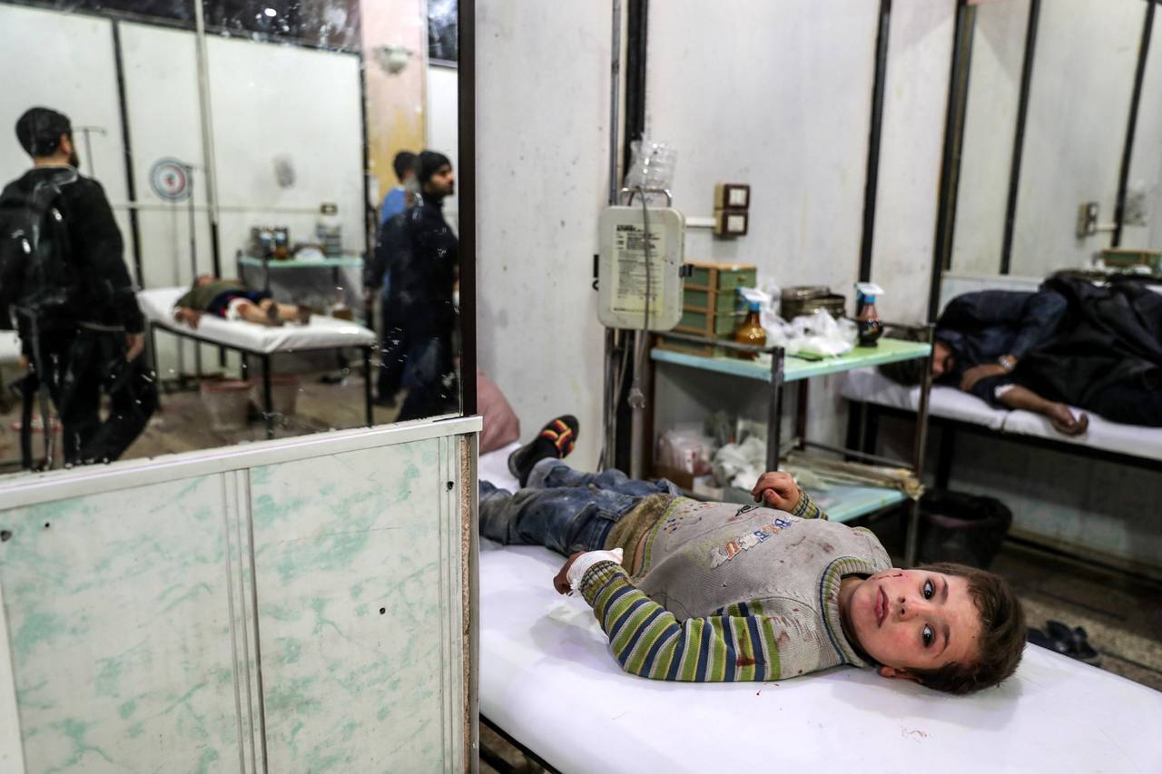 Sobreviven. Un niño sirio herido en un bombardeo fue atendido en un hospital de campo de Douma. (EFE)