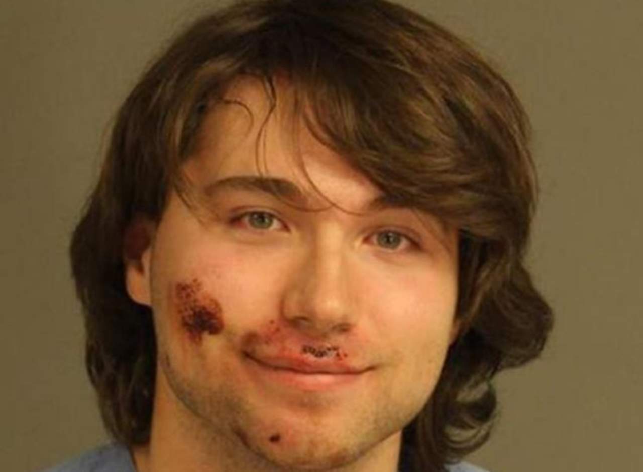 El joven luce con todo y sangre aún en la cara en su fotografía policial. (INTERNET)