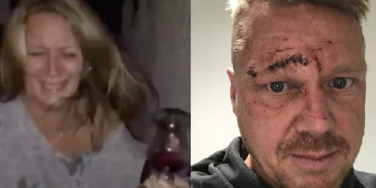 Mujer estrelló copa de vino contra el rostro de su pareja