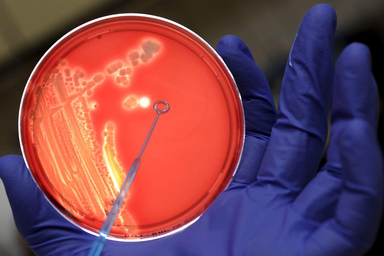 Crean un agente antibacteriano que trata infecciones resistentes