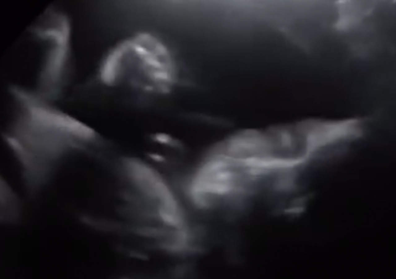 Bebé saluda a sus padres durante ultrasonido