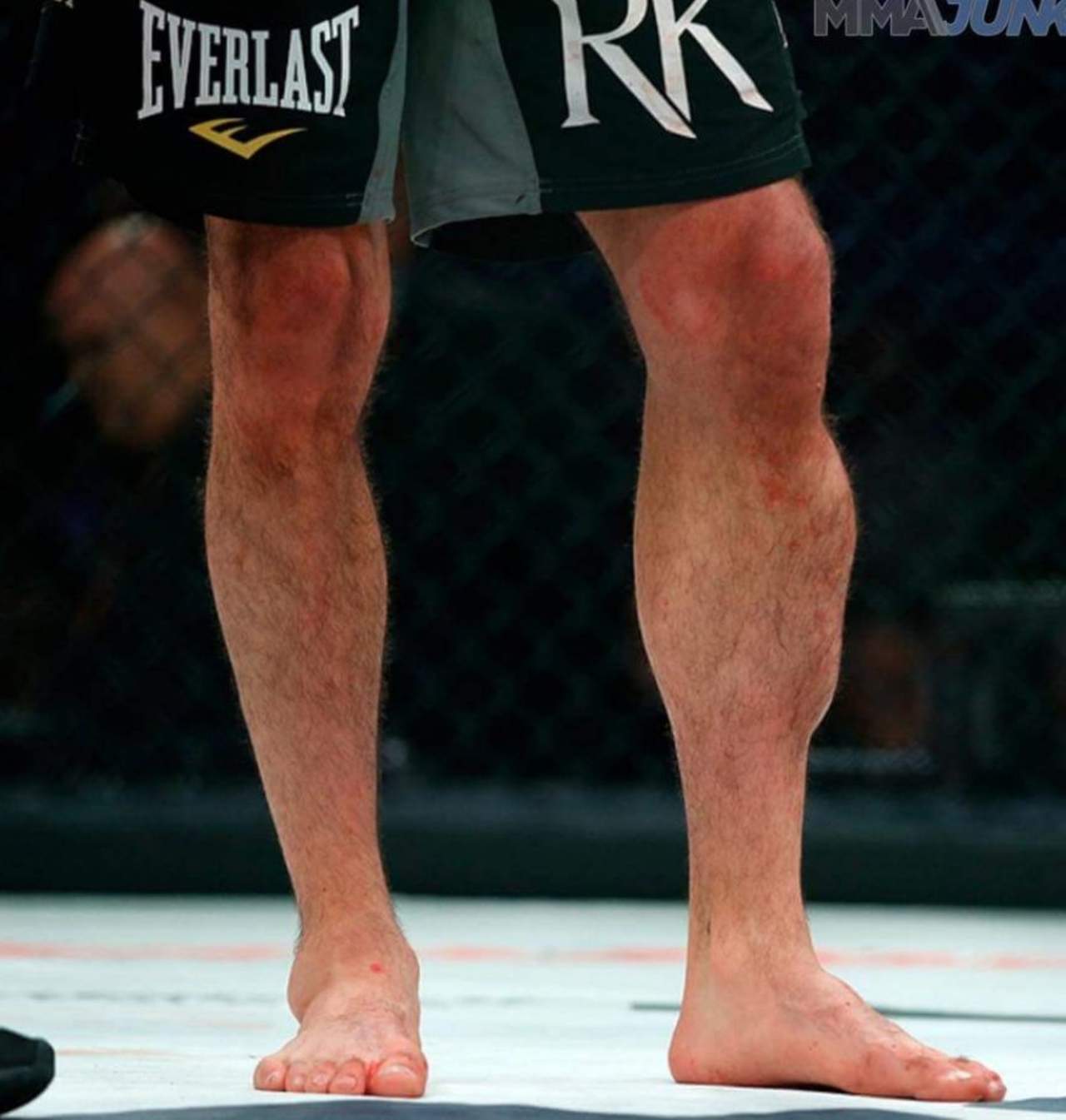 Así lucen las piernas luego de una pelea en la UFC