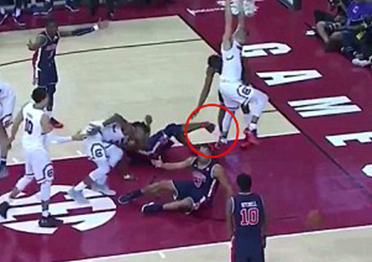 VIDEO: Jugador de basquetbol universitario sufrió atroz fractura