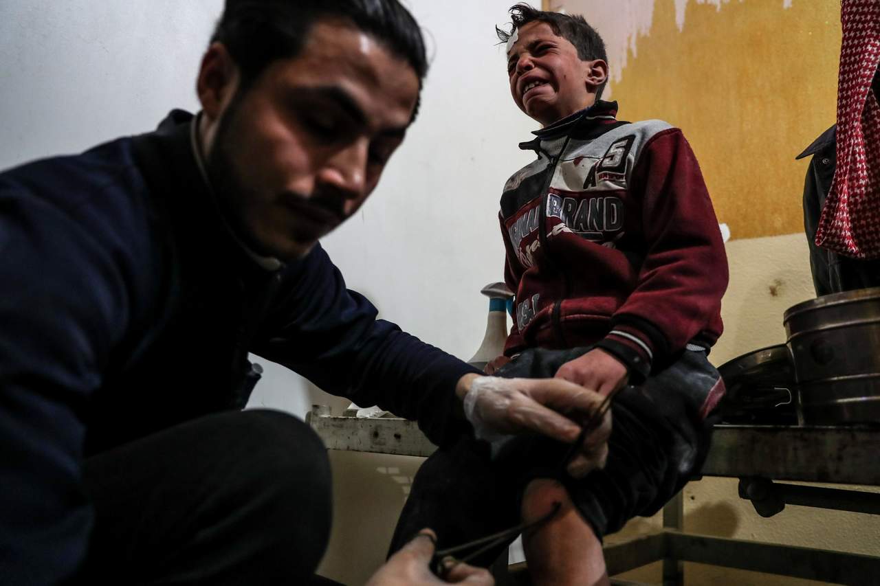 Insoportable. Un médico saca las esquirlas de la herida del pequeño en uno hospital de Douma.(AP y EFE)