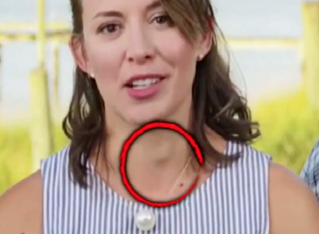 La mujer padece cáncer de tiroides. (INTERNET)