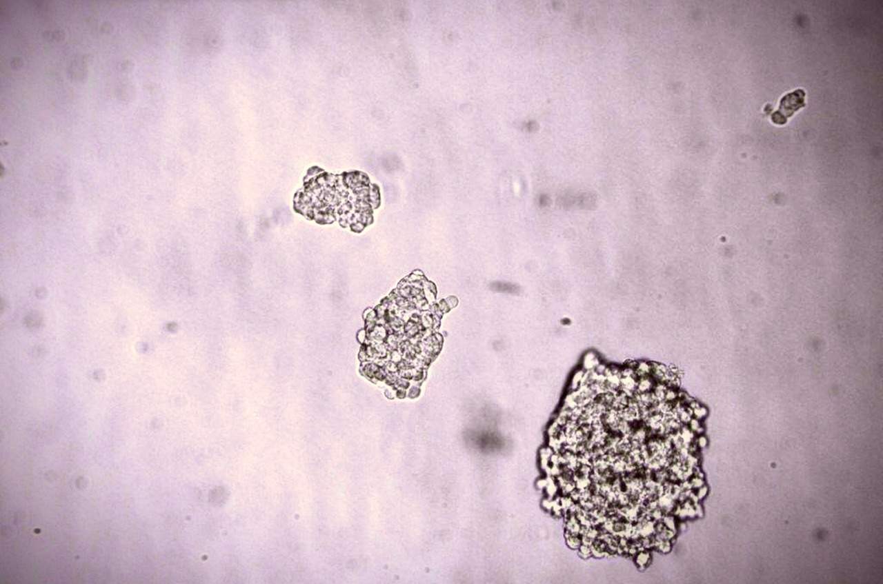 Investigadores generaron en un laboratorio células hepáticas a partir de células madre y por medio de estas generaron un hígado 'in vitro'. (ARCHIVO)