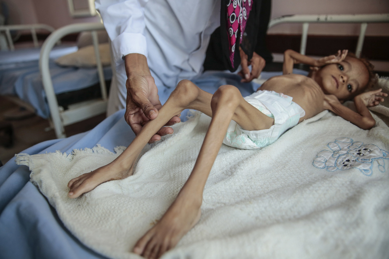 La vida de los niños en el Yemen se agota