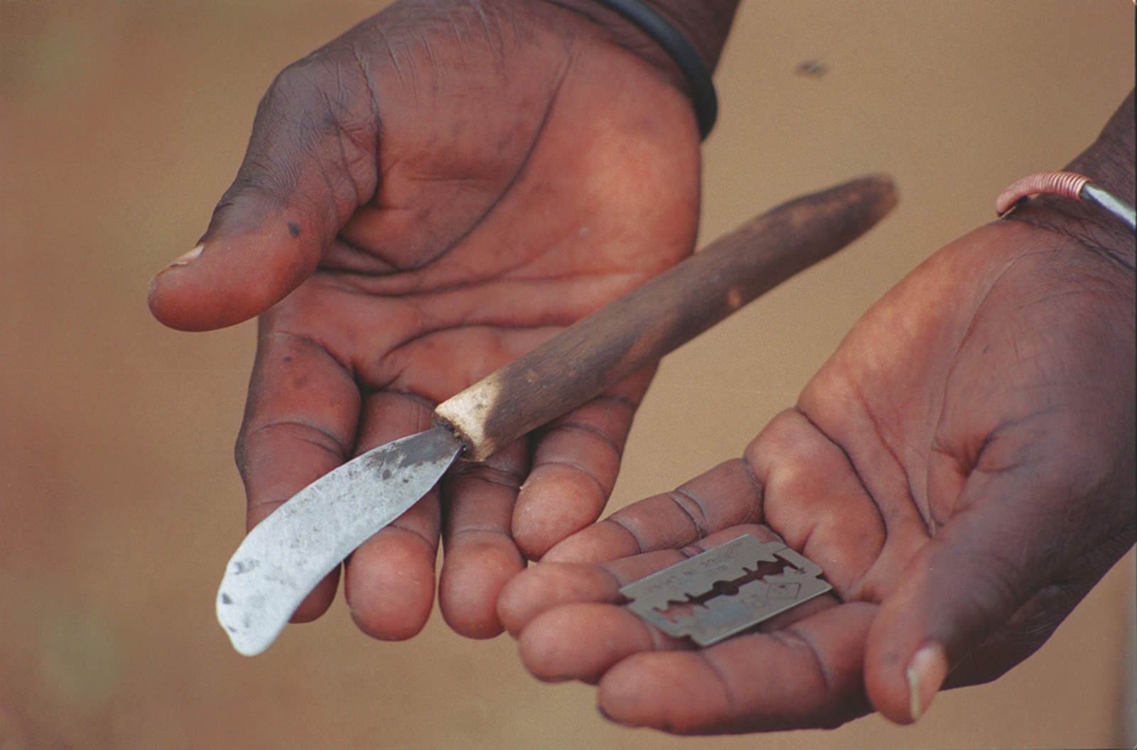 La mutilación genital femenina es común en tribus africanas como la masái. Foto: World Vision