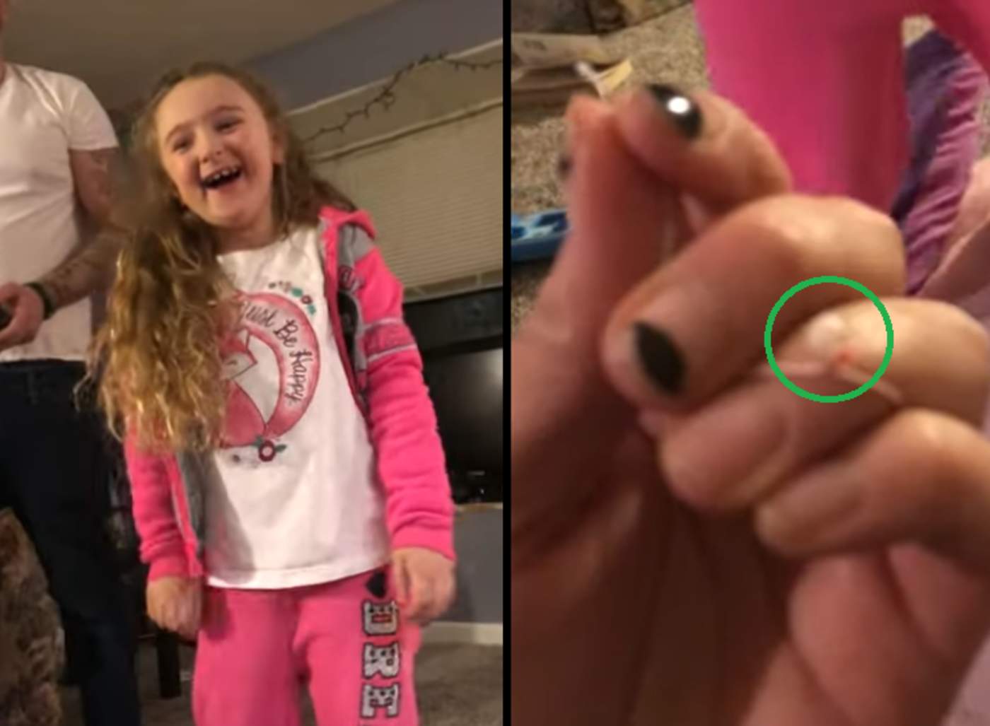 Utilizan un dron para quitarle diente suelto a su hija