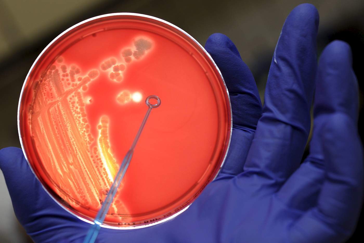 Hallan nuevo proceso de resistencia a fármacos en bacterias