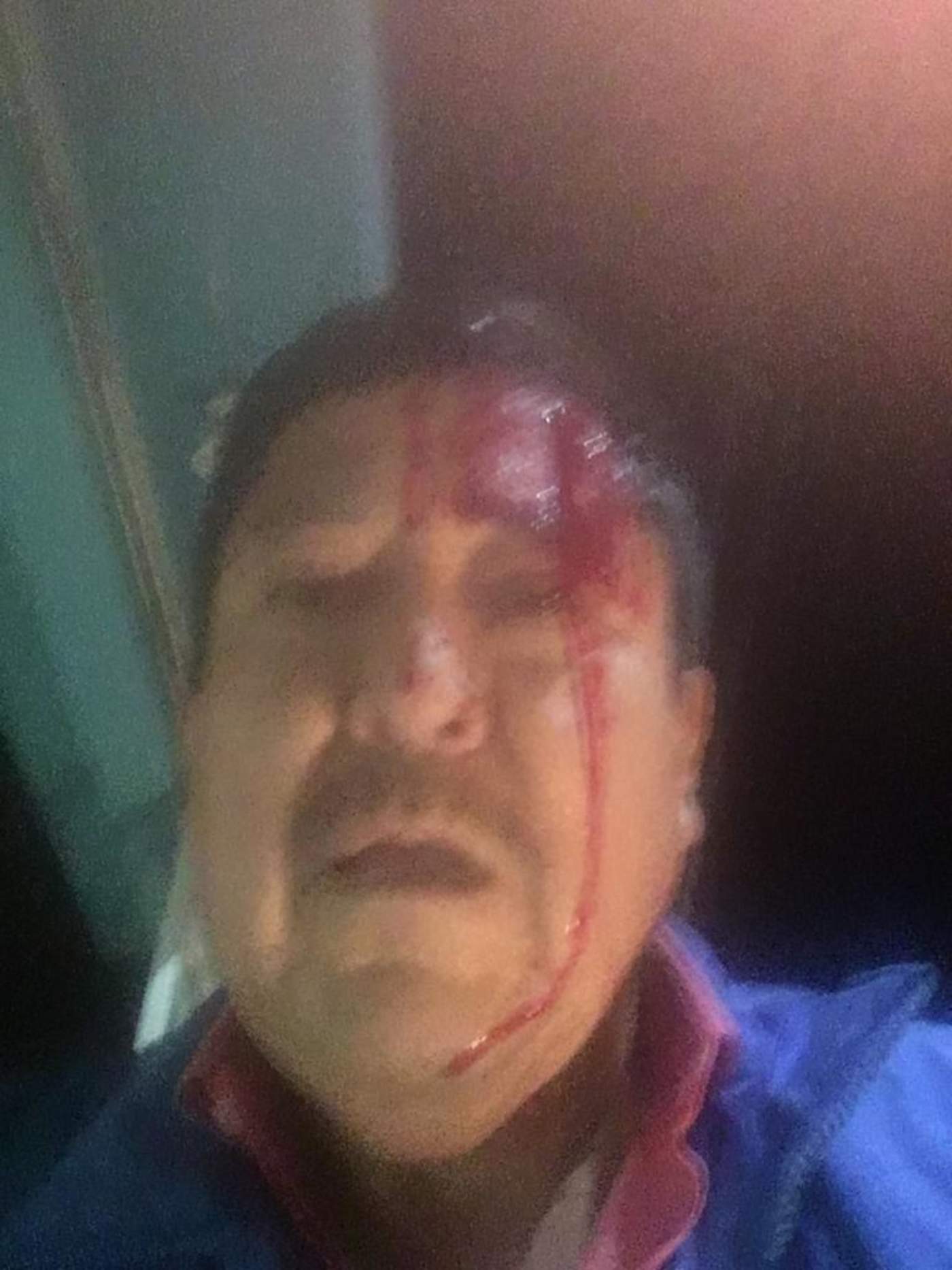 Martín Valtierra García, director del medio Contrastes de Comondú, en Baja California Sur, fue agredido a batazos esta noche, por sujetos encapuchados, cuando llegaba a su domicilio en aquella región del estado. (ESPECIAL)