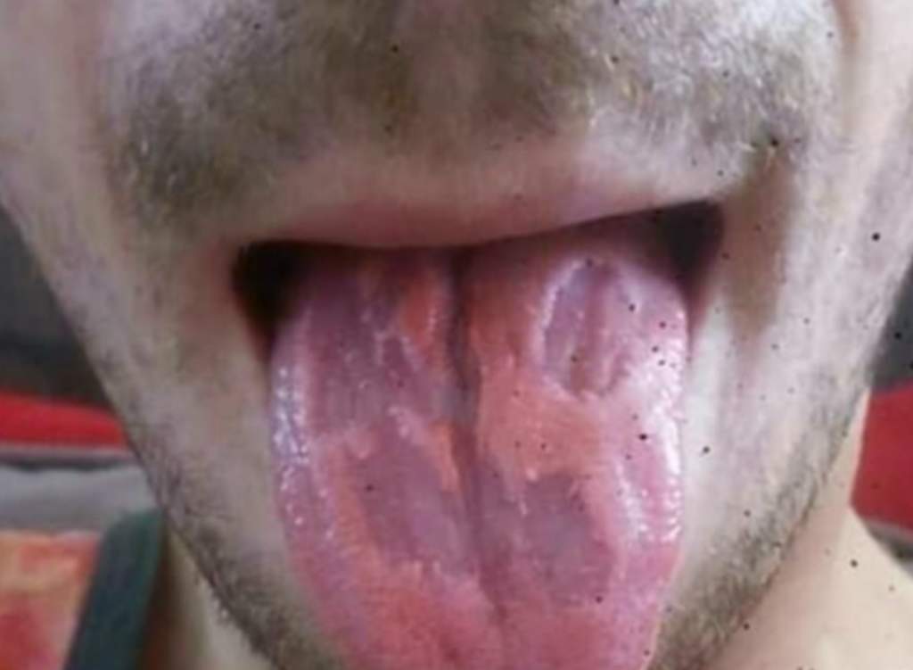 Tomar 6 bebidas energizantes al día destruye su lengua