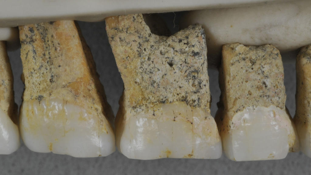 Dentadura superior derecha de Homo luzonensis. (EFE)