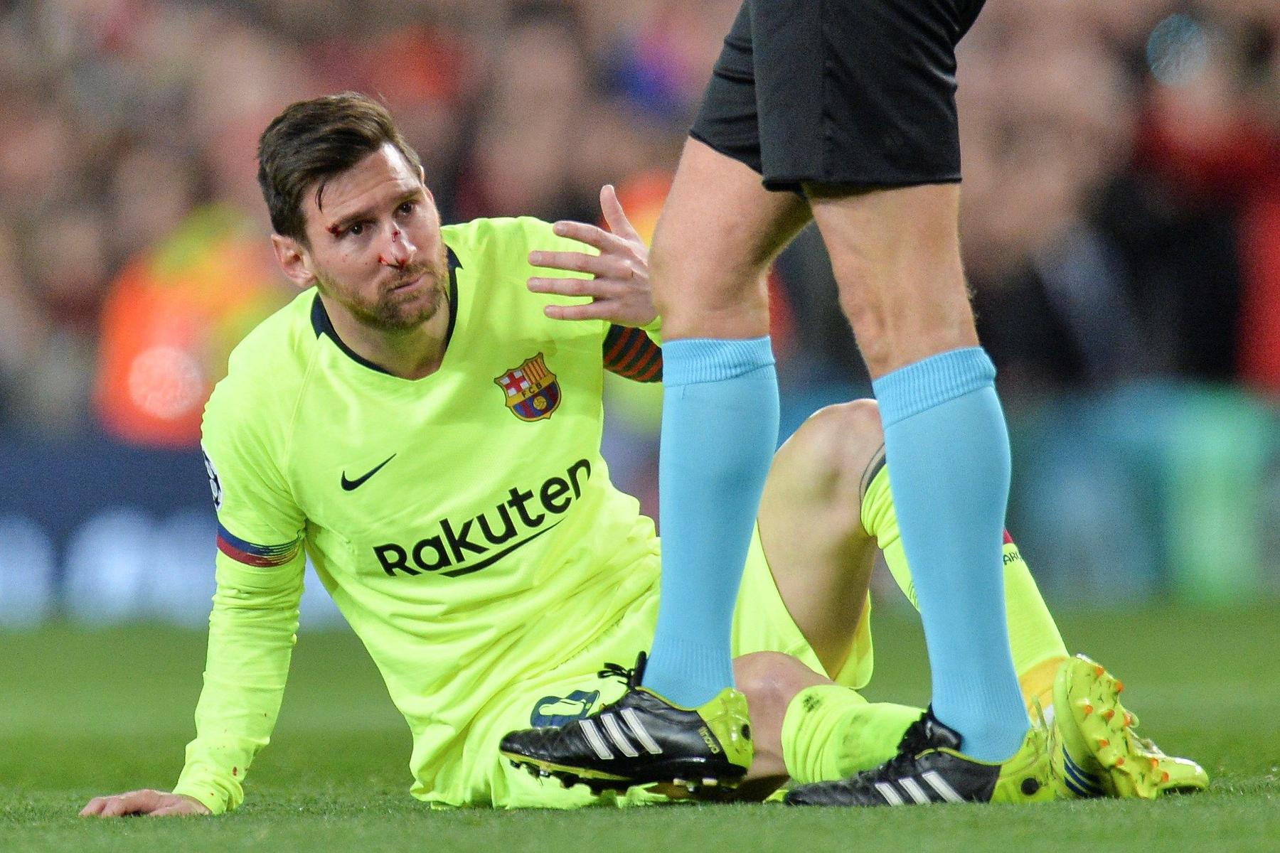 Golpe de Messi se queda en susto