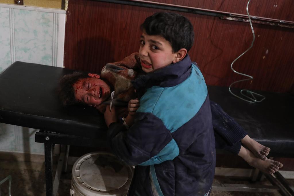 Un niño mientras reconforta a su hermano herido después de un bombardeo el 8 de febrero de 2018 a Douma, en la localidad de Guta. La historia ganó el segundo lugar en la categoría “Noticias destacadas - Historias”. (WORLD PRESS PHOTO-EFE)