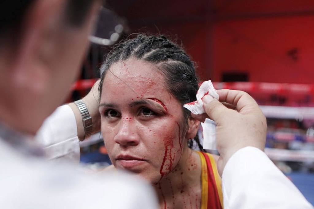 Ese gran y profundo corte arriba de su ceja izquierda no le permitió en 2016 continuar su combate ante la venezolana Ana Lozano. (Zanfer)