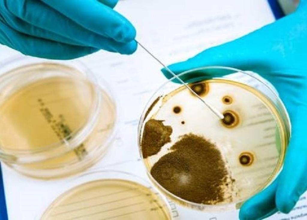 Las autoridades sanitarias informaron también de que siguen siendo 204 los casos confirmados por la bacteria de la listeria. (ESPECIAL)