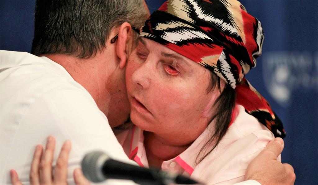 Carmen Blandin Tarleton, de 51 años, sufrió quemaduras en el 80% de su cuerpo cuando su esposo la golpeó con un bate de béisbol y roció su cuerpo con lejía en 2007. (ESPECIAL)