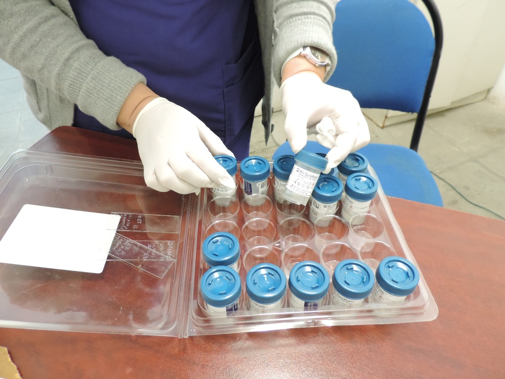 Son 142 los casos de pacientes atendidos por infección del Virus de Papiloma Humano en el estado de Durango. (EL SIGLO DE TORREÓN)