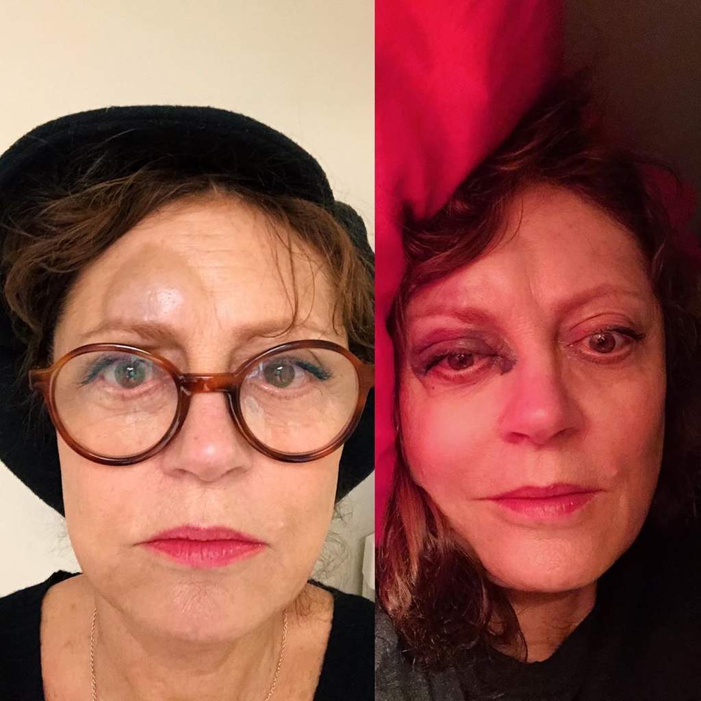 Susan Sarandon comparte foto en Instagram que
muestra su rostro con un moretón e inflamación en la frente. (ESPECIAL) 