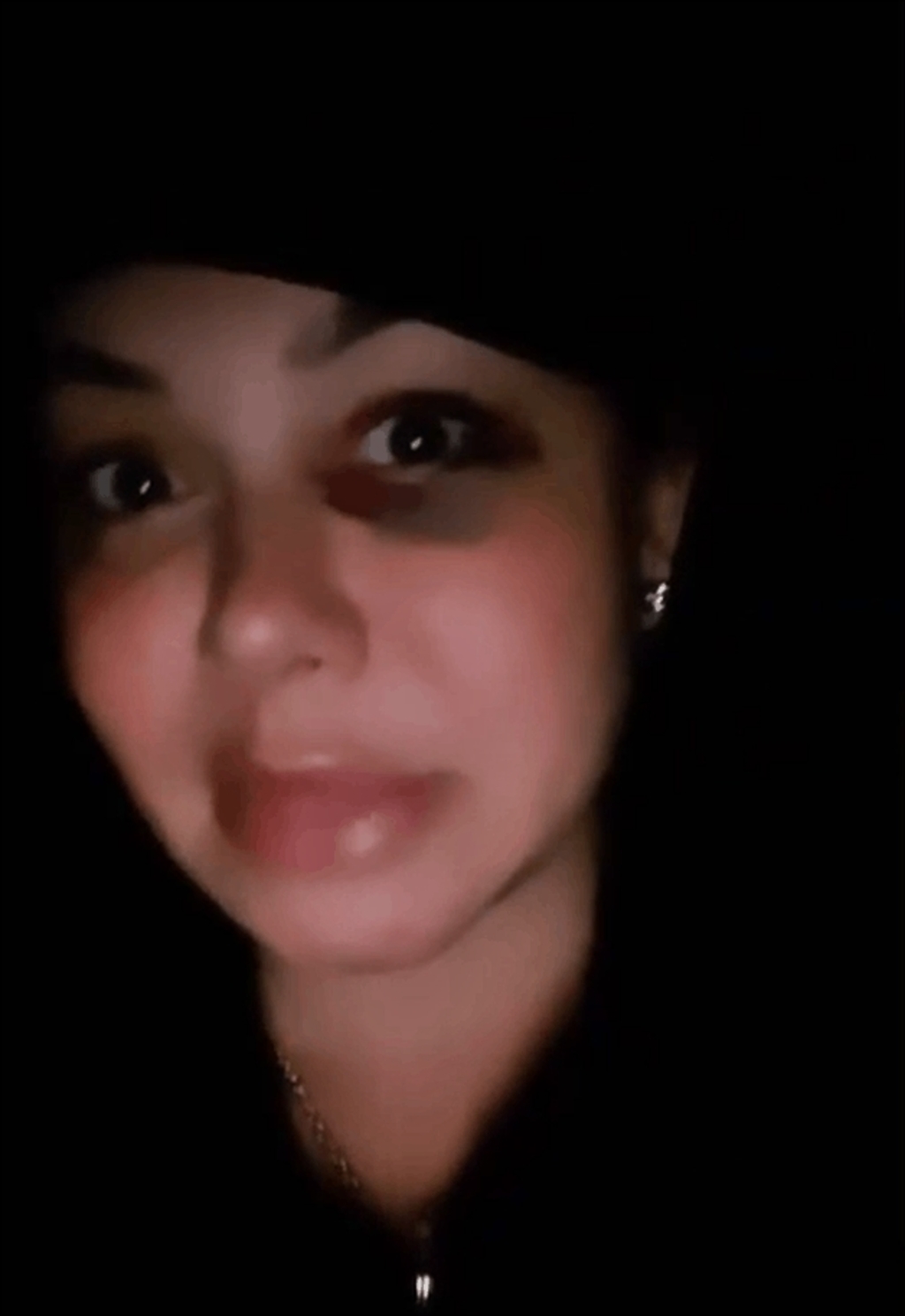 Aclaración. La cantante compartió por medio de sus redes sociales que se sometió a un tratamiento de belleza y desmitió violencia. (ESPECIAL) 