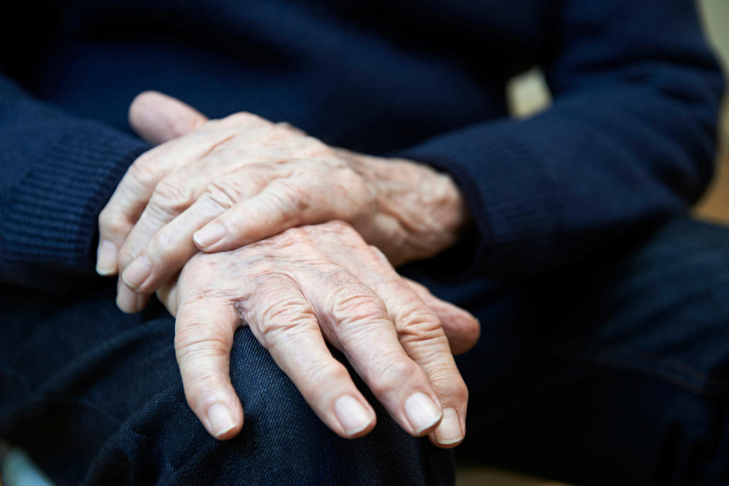 Las personas que desarrollan la enfermedad de Parkinson antes de los 50 años podrían haber nacido con células cerebrales desordenadas que no se detectaron. (ARCHIVO) 