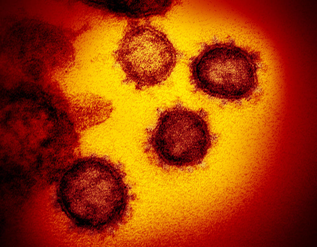 La OMS ha denominado a la enfermedad como COVID-19, en referencia a su origen a finales del año pasado y a que es causada por un coronavirus. (ESPECIAL)