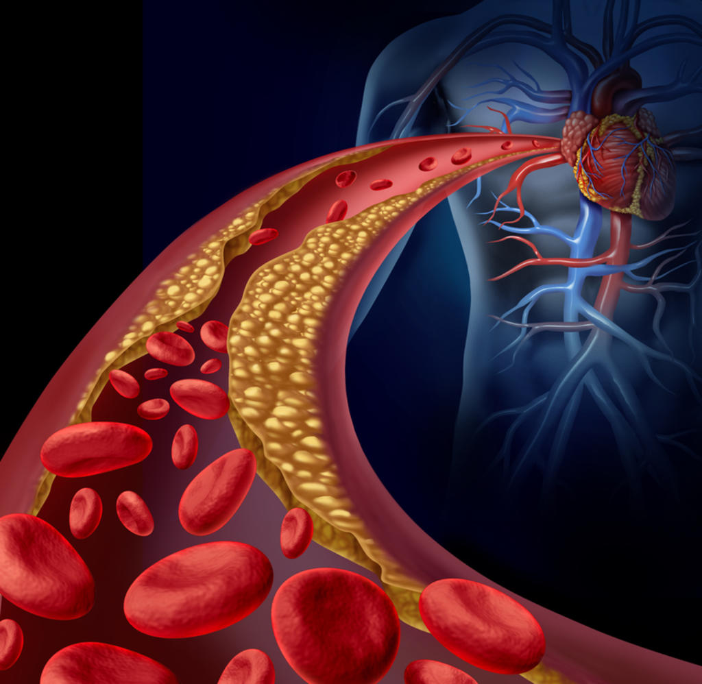 La grasa en las arterias podría desempeñar un papel importante para mantener saludables los vasos sanguíneos. (ARCHIVO) 