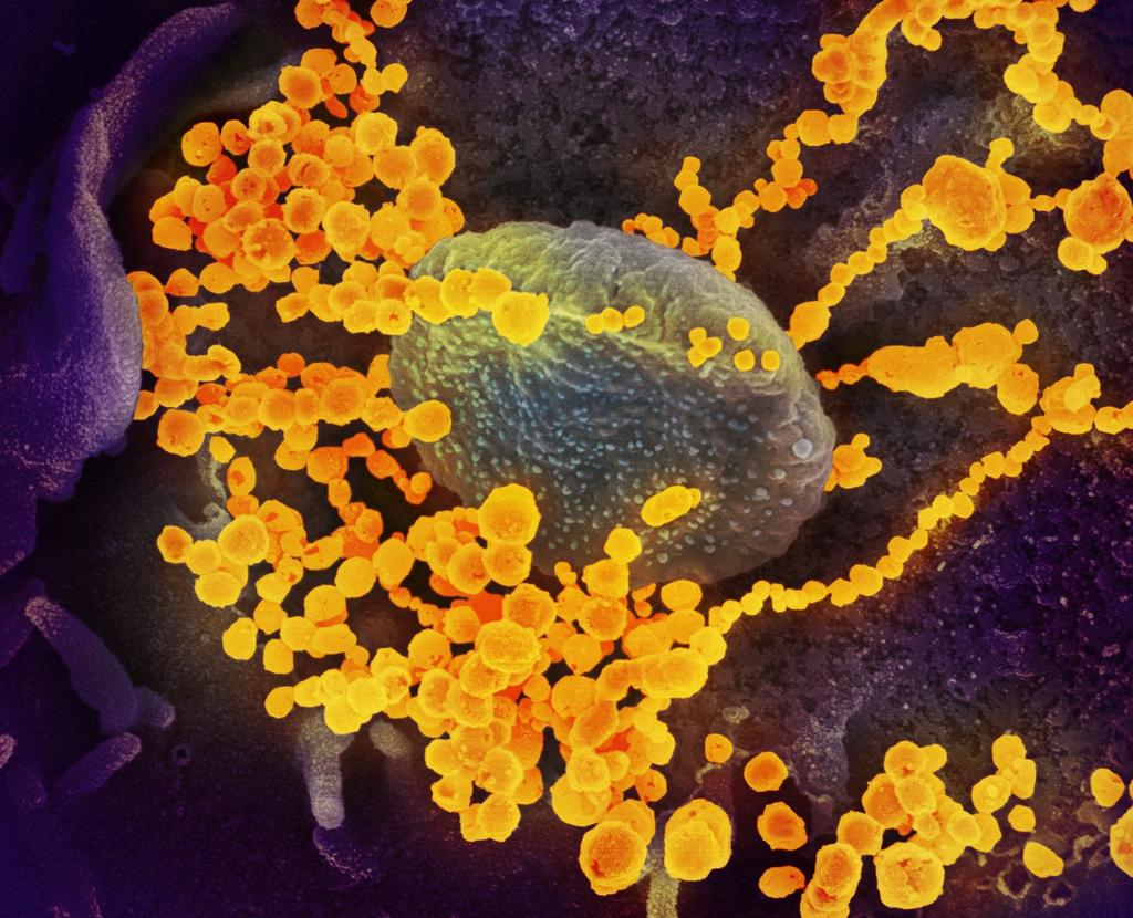 Un grupo de científicos de la Universidad de Alberta, en Canadá, analiza la efectividad de un medicamento destinado al ébola que podría ser efectivo para tratar la nueva cepa de coronavirus COVID-19. (ARCHIVO) 