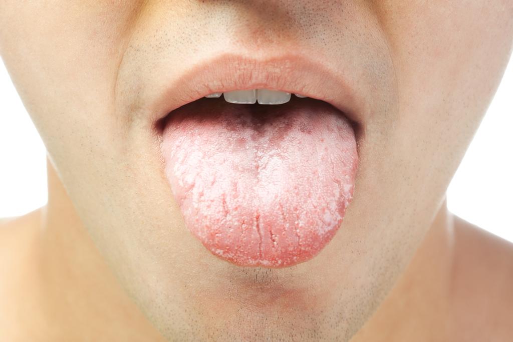 El microbioma de nuestra boca tiene un nivel organizativo muy complejo y altamente estructurado. (ARCHIVO) 
