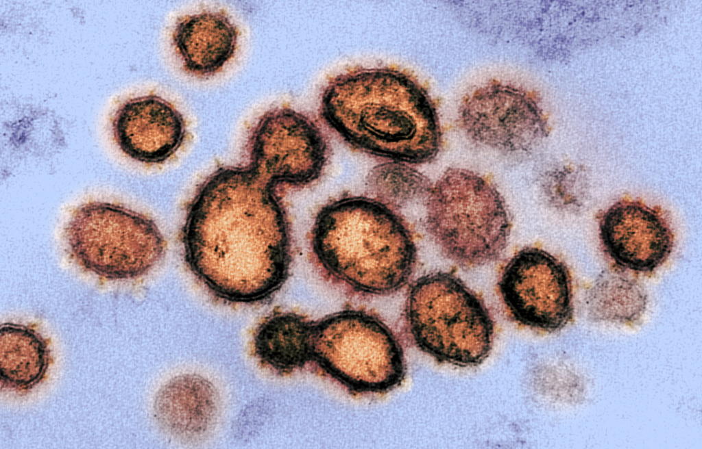El nuevo coronavirus no solo ha mutado, sino que se ha detectado una nueva cepa dominante a nivel mundial que es más contagiosa que las que se esparcieron al comienzo de la pandemia, revela un estudio encabezado por científicos del Laboratorio Nacional Los Álamos, en Estados Unidos. (ARCHIVO)